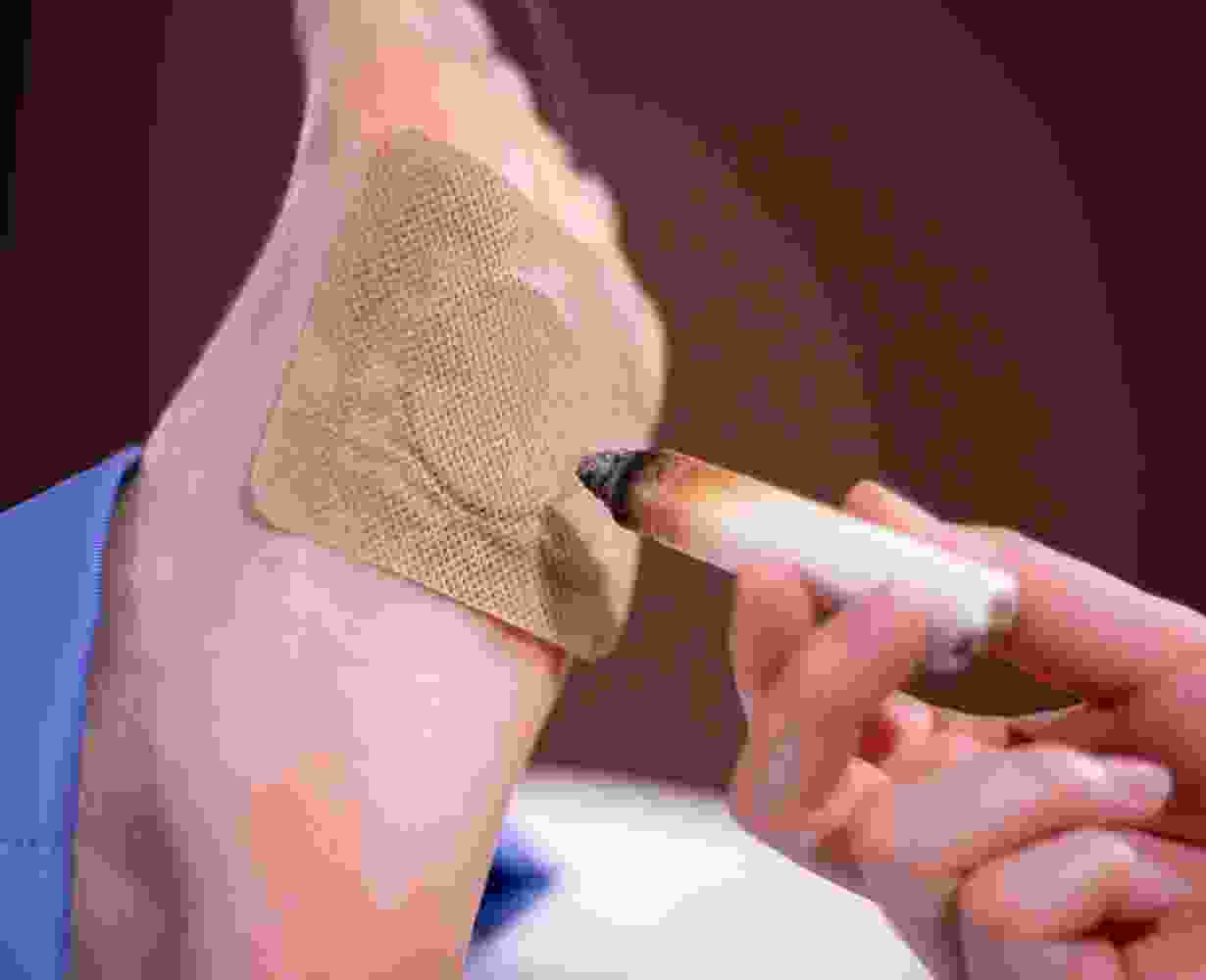 Moxibustion