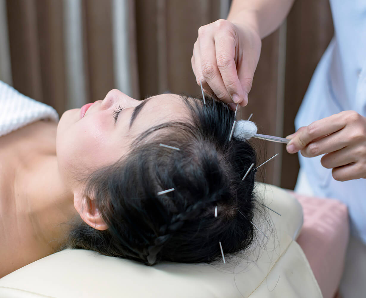 Hair Transplant Treatment